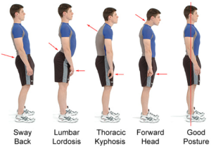 Posture Challenge Issued by Personal Trainer Greg Jasnikowski 